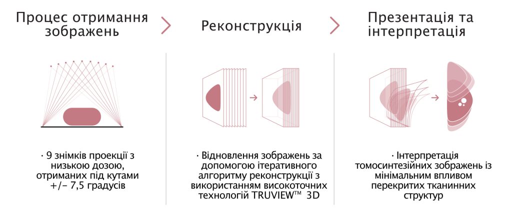 Система мамографічна цифрова з функцією томосинтеза AIDIA Luxe  