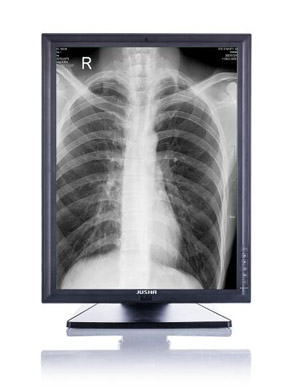 Mammography Diagnostic Display JUSHA-M33C  
