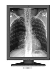 Fluorograph (X-ray system for chest). X-ray Radiology System BreeZe EBP-D01  