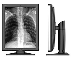 Оцифровка аналогових рентгенівських апаратів 