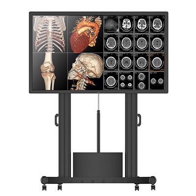 Medical Demonstration Display JUSHA-S8420 for conciliums, seminars, lectures  