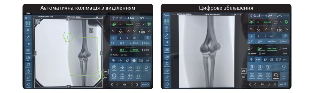 Система рентгенівська флюороскопічна <nobr>EXTRON 3,</nobr> (C-Arm) виробництва DRTECH Corp. (Республіка Корея)  