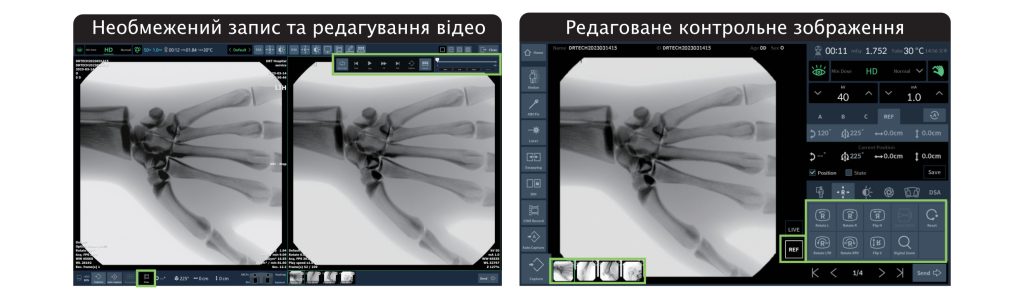 Система рентгенівська флюороскопічна <nobr>EXTRON 3,</nobr> (C-Arm) виробництва DRTECH Corp. (Республіка Корея)  