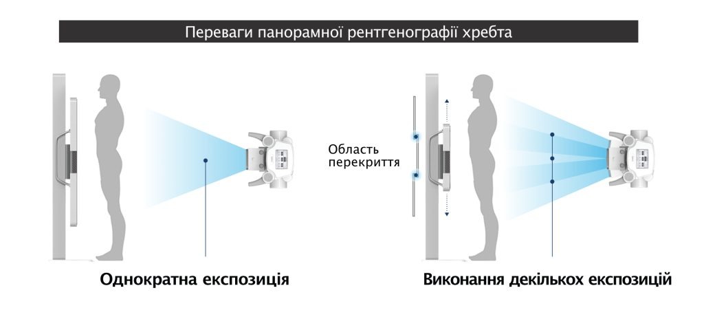 Цифровий плоскопанельний рентгенівський детектор EXPD 129P/EXPD 129PG  