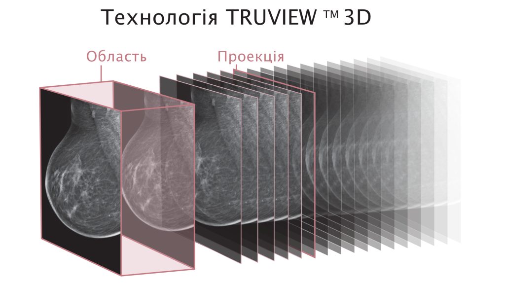Система мамографічна цифрова з функцією томосинтеза AIDIA Luxe  