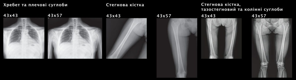 Цифровий плоскопанельний рентгенівський детектор EXPD 4357A  