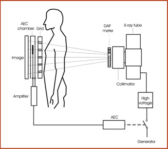 Іонізаційні камери AEC Sensor (експонометри VacuTec) 