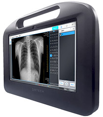 Оцифровка аналогових рентгенівських апаратів  
