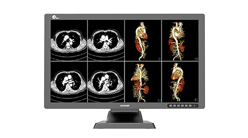 Кольоровий діагностичний монітор JUSHA-C42E з подвійним екраном  
