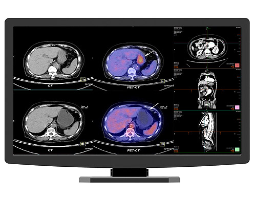 Color Medical Display JUSHA-CR22  