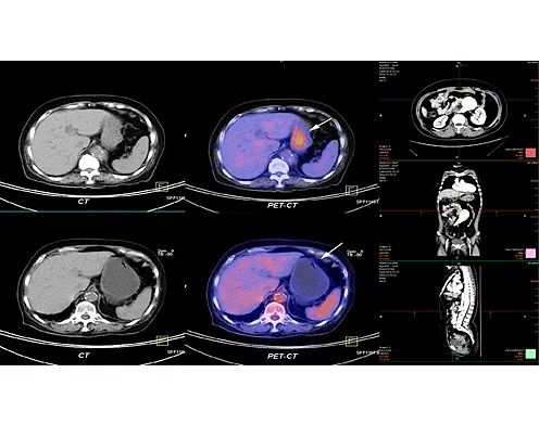 Color Medical Display JUSHA-CR22  