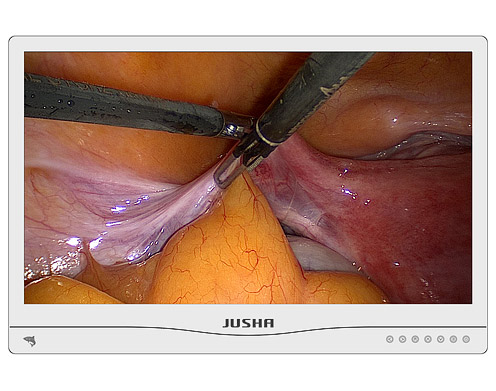 Хирургический медицинский монитор Jusha-E240AG  