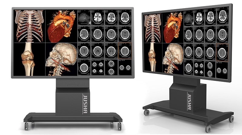 Medical Demonstration Display JUSHA-S9810 for conciliums, seminars, lectures  