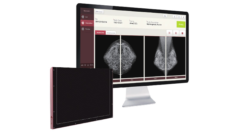 Як зробити цифровий апгрейд мамографічного апарату? Перетворіть свій аналоговий мамограф на цифрову систему. 