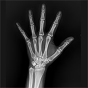 Оцифровка аналогових рентгенівських апаратів  